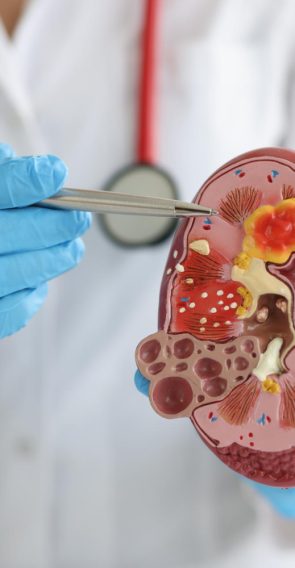 urology-treatment-kidney-diseases-closeup